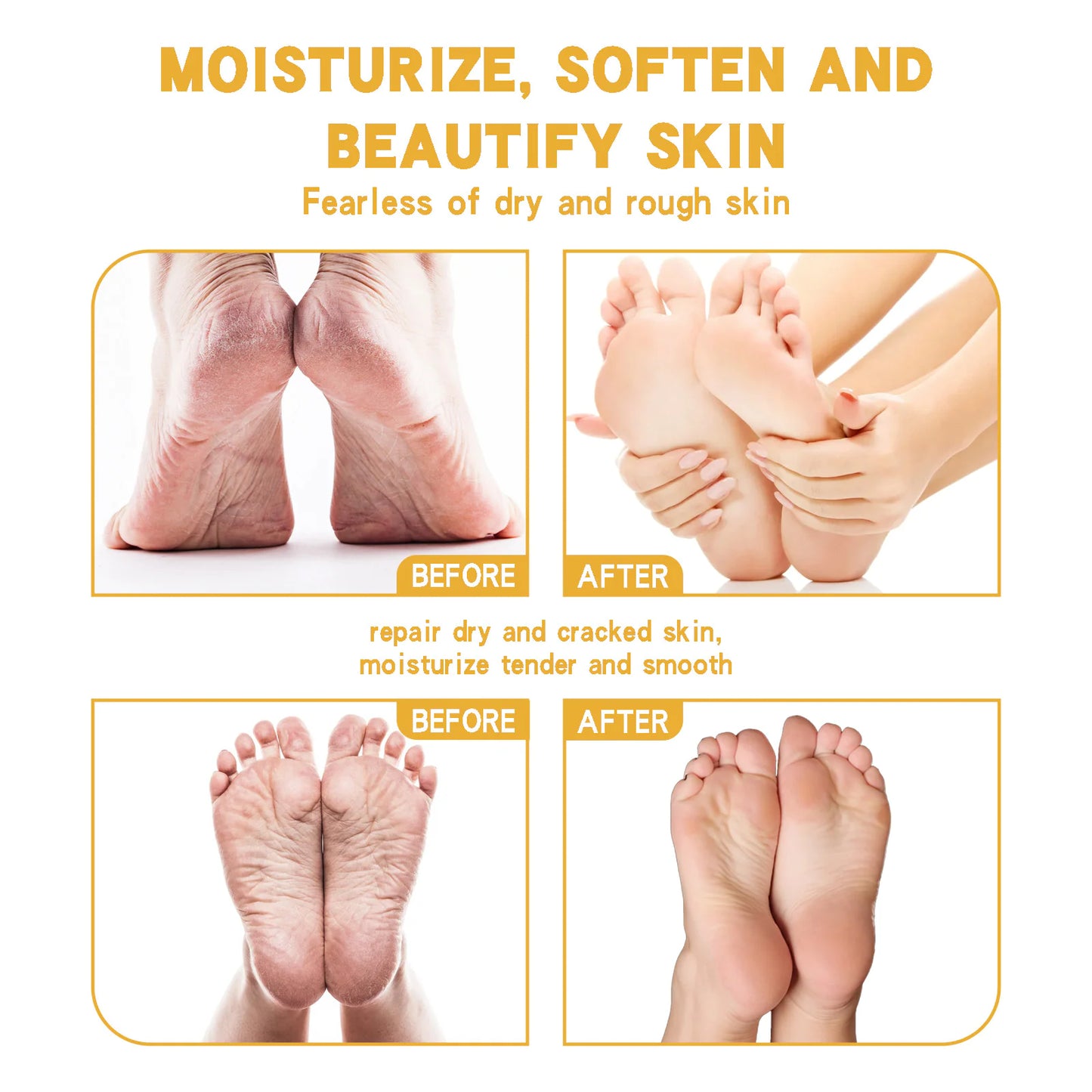 Shurun Cream For Chapped Skin Foot Care Moisturizing And Anti-cracking